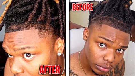 Ways To Avoid Hairline Pushback With Dreadlocks How To Fix Your