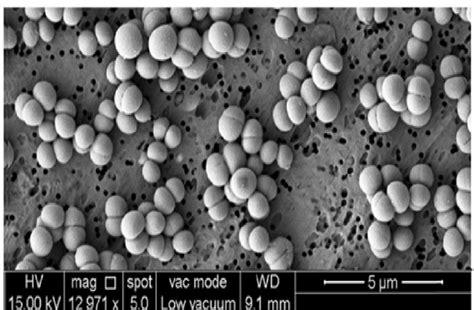 Staphylococcus Aureus Under Microscope 1000X