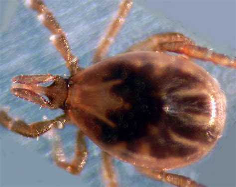 Lyme Disease Pathophysiology Wikidoc