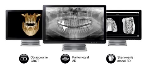 Diagnostyka Cbct Rtg Cefalometria Rtg Pa Pantomogram Warszawa