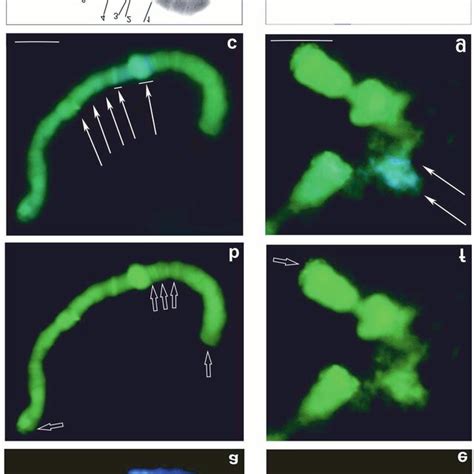 Acet Orcein Staining Of The Polytene Chromosomes Of Chironomus