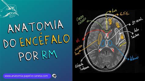 Anatomia Do Enc Falo Por Rm Dicas De Como Localizar As Estruturas No