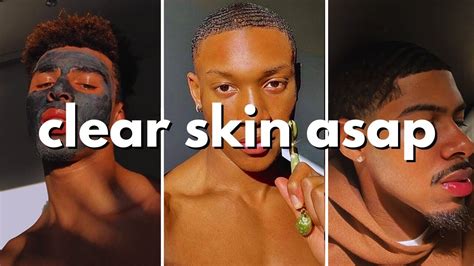 How To Get Clear Skin For Guys Asap No Bs Guide Youtube