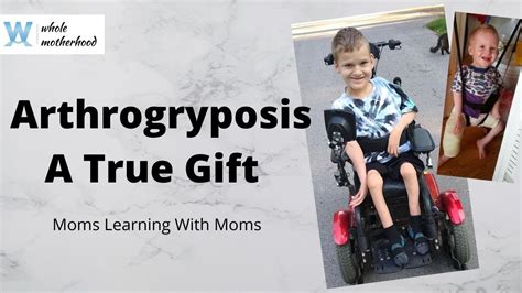 Arthrogryposis Youtube