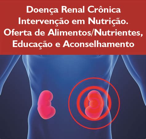 Doença renal crônica Intervenção em nutrição Oferta de Alimentos