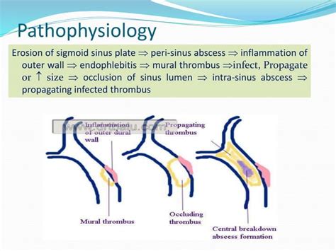 Otitis media intracranial complications