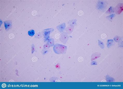 Muestra Histológica Células Epiteliales Escamosas Bajo Microscopio