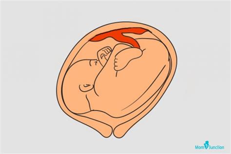 Transverse Lie: Causes And Ways To Turn The Baby