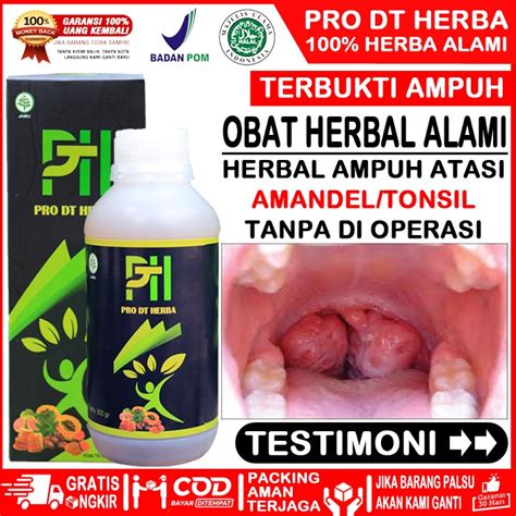 Jual Obat Amandel Herbal Original Paling Ampuh Untuk Anak Dan Dewasa