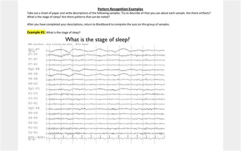 EEG Sample Slides Flashcards Quizlet