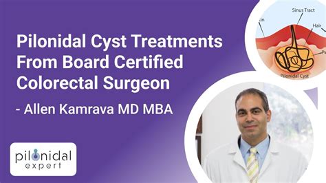 These Are Your Options For Pilonidal Cyst Treatments Youtube