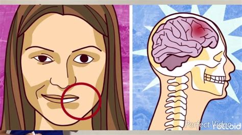 Accidente Cerebrovascular 🧠 Fisiopatología Del Acv Isquémico Y Hemorrágico Fácil De Aprender