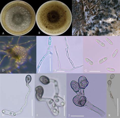 Figure 7 From Identification And Genetic Diversity Analysis Of The