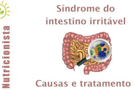 síndrome do intestino irritável EuPaciente