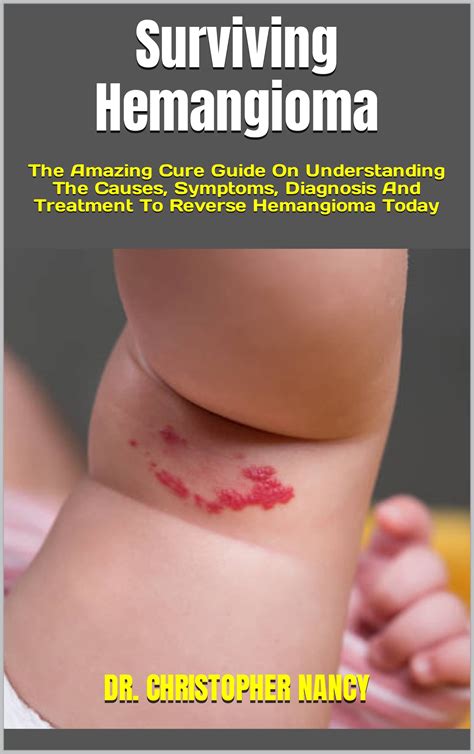 Surviving Hemangioma The Amazing Cure Guide On Understanding The