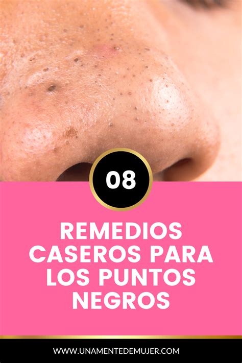 Remedios Caseros Naturales Para Los Puntos Negros Belleza