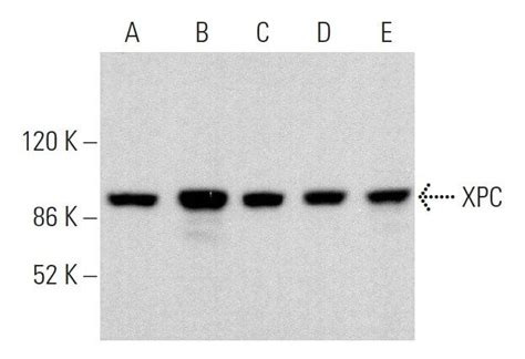 Xpc D Scbt Santa Cruz Biotechnology