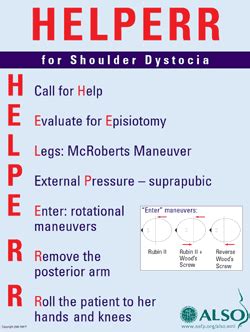 HELPERR- for shoulder dystocia | Midwifery, Nursing school tips ...