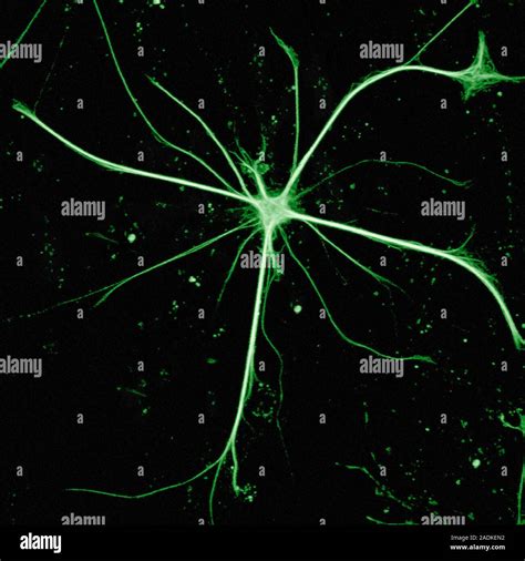 Astrocyte Nerve Cell Confocal Light Micrograph Of An Astrocyte Nerve