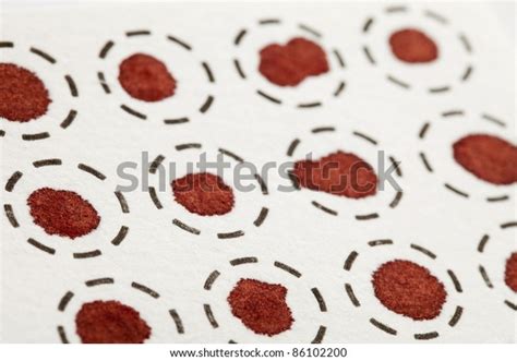 1,114 Spot Test Analysis Images, Stock Photos, 3D objects, & Vectors ...