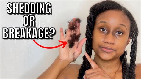 Shedding Vs Breakage How To Tell The Difference Natural Hair Youtube