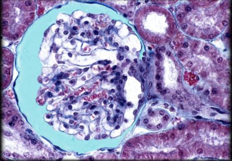 HISTOLOGY URINARY Flashcards Quizlet