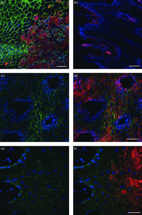 Expression Of Avb6 In Fmdv Infected Interdigital Skin Sections Were