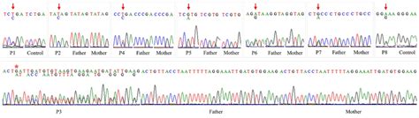 Sanger Sequencing For Variant Validation And Segregation Analyses In