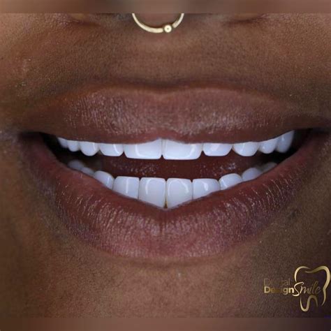 Gallery - Dental Design Smile