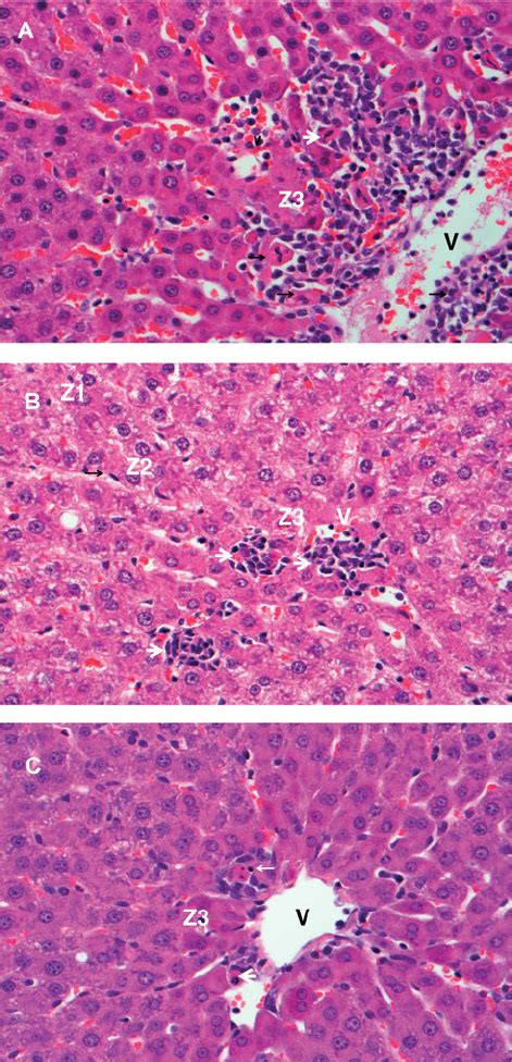 Representative Hematoxylin And Eosin Stained Liver Sections From