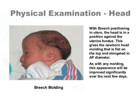 Newborn Assessment by Hadi Hospital NICU.