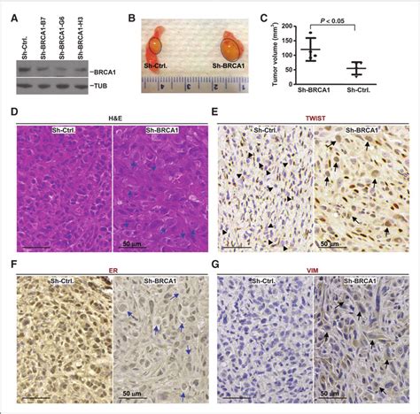 Knockdown Of Brca1 In Luminal Cancer Cells Increases Tumor Formation Download Scientific