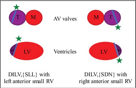 Figure 1 From Ventricular Septation For Double Inlet Left Ventricle