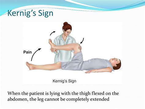 Ppt Meningitis Powerpoint Presentation Free Download Id2916030