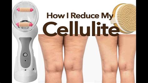 2 Home Cellulite Treatments How I Reduced My CELLULITE At Home Anti