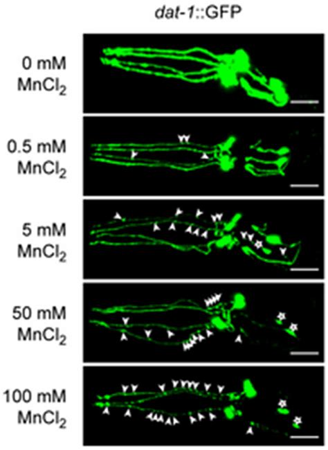 Degeneration Of Dopaminergic Neurons In C Elegans Following Mn