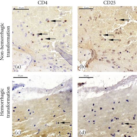 Immunohistochemical Staining Images Of CD4 CD25 Treg Cells In Serial