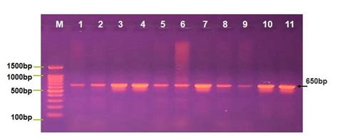 Agarose Gel Electrophoresis Image That Showed The Pcr Product Analysis