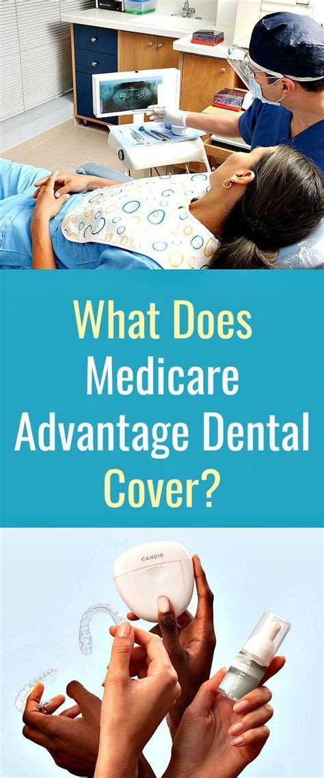 Does Medicare Cover Dental Implants Cares Healthy