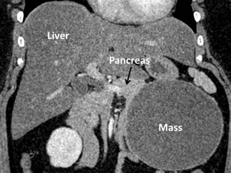 Hepatobiliary System Radiology Cases