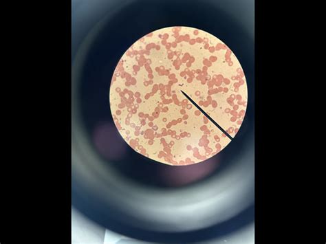 Lab 10 Hemoflagellates And Blood Apicomplexa Flashcards Quizlet