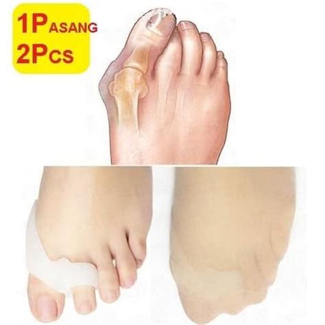 Jual VIRAL Bunion Penyangga Jari Kaki Jempol Bengkok Pelurus Tulang