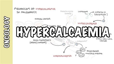 Hypercalcemia in malignancy - causes, pathophysiology, symptoms ...