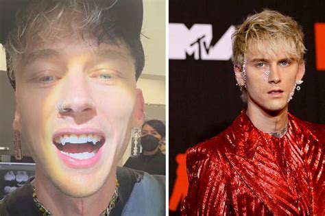 Machine Gun Kelly Shows Off Fangs And New Neck Tattoo In Major Transformation