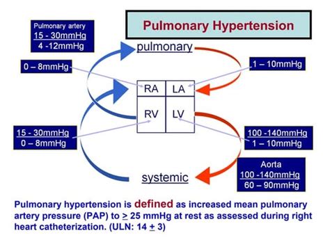 Diagnosis And Classification Of Pulmonary Hypertension