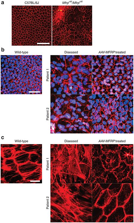 Immunofluorescence On Rpe Without And With Aav Mfrp Treated A A Flat