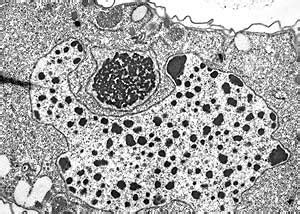 Why Sequence Tetrahymena thermophila? - DOE Joint Genome Institute