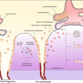 PDF Elucidating The Pathogenesis Of Pre Eclampsia Using In Vitro