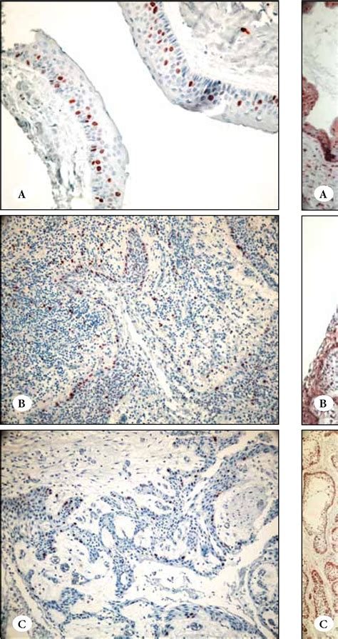 Figure From Expressions Of Bax Bcl And Ki In Odontogenic