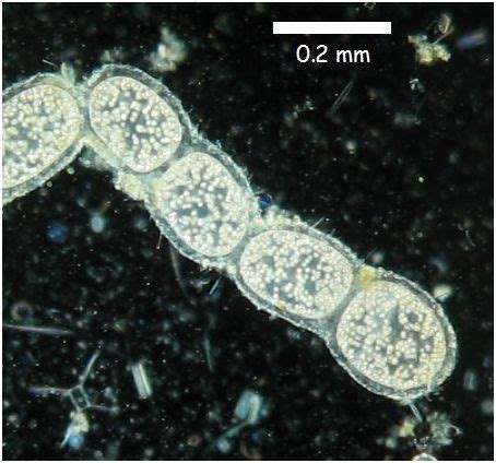 Largest bacteria | Face, Bacteria, Organs